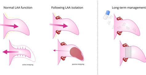 Functional Implications Of Left Atrial Appendage Isolation With Normal Download Scientific