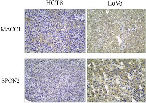 Immunohistochemical Staining Of Human Colorectal Cancer Lovo And Hct