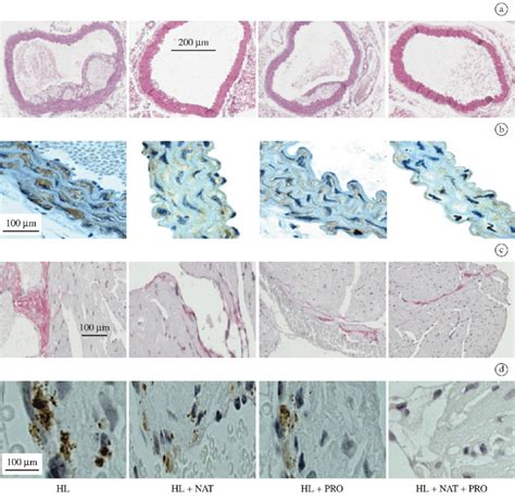 Photomicrographs Of Histological Sections Of The Aorta Panel A