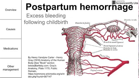 Postpartum Hemorrhage Youtube