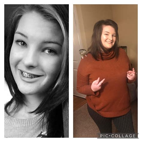Ugly Teeth 14 And Fluffy 21 To Confident Queen 25 Ruglyduckling