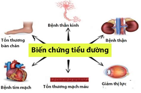 Hình Ảnh Bệnh Tiểu Đường Nhận Biết Và Phòng Ngừa Hiệu Quả