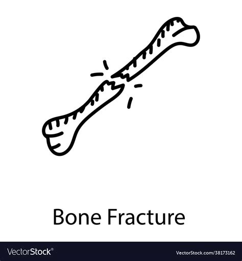 Bone Fracture Clip Art