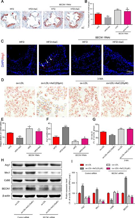 Autophagy Inhibition Abolished Asc Mediated Antiatherosclerotic Effects