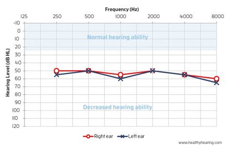 Learn What To Expect During A Hearing Test