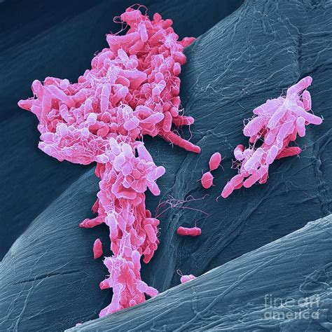 Salmonella Bacteria Photograph By Steve Gschmeissner Science Photo Library Pixels