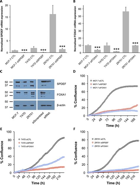 SPDEF And FOXA1 Expression And Activity In ER Breast Cancer Cell