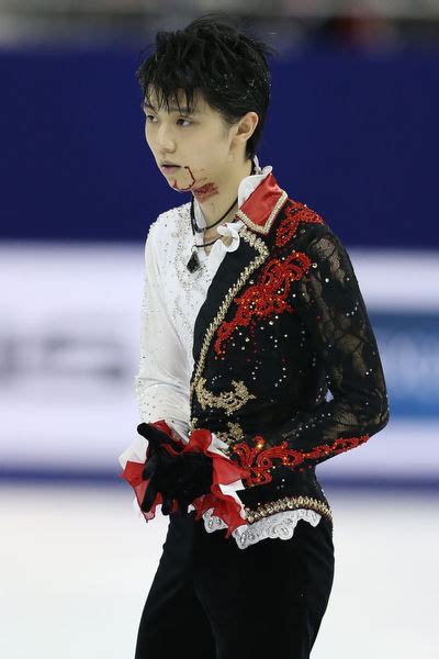 【海外の反応】あなたは氷上の勇敢な戦士！ ～羽生結弦、流血アクシデントを乗り越え2位 なりゆき