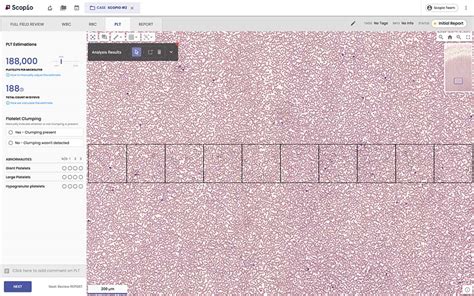 Full Field Peripheral Blood Smear Application Scopio Labs