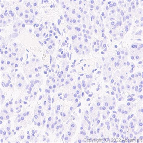 Recombinant Anti Aldolase C N Terminal Antibody Epr Ab