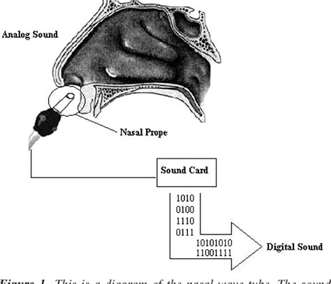 Figure 1 From Frequency Spectra Of Normal Expiratory Nasal Sound