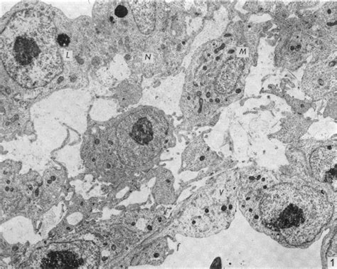 Figure From Ultrastructure Of The Blood Vessels In The Chick