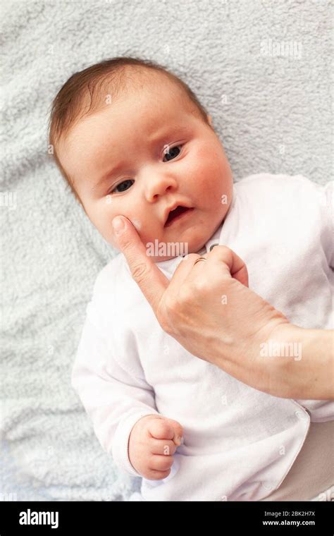 Baby With Atopic Dermatitis Getting Cream Put Care And Prevention Of