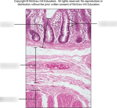 Colon Slide Diagram Quizlet