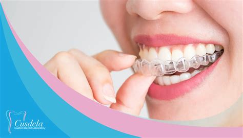 Dental Invisalign Everything You Need To Know Blog