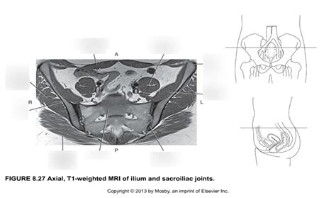 Axial MRI Of Ilium And Sacroiliac Joints Diagram Quizlet