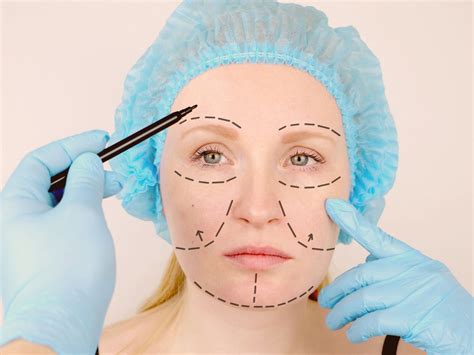 Facelift Recovery How To Heal Faster And Have Better Results