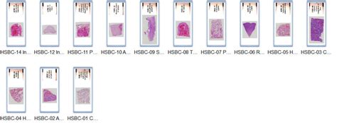 High-resolution scan copies of pathology slides, digital pathology slides