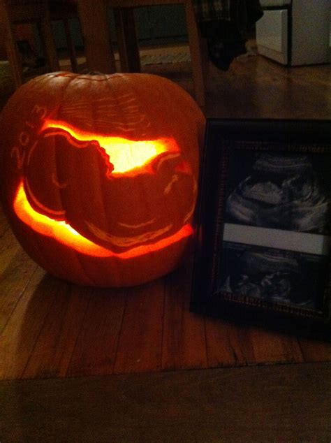 Turn Ultrasound Into Template Using Photocopier Celebrate Babies