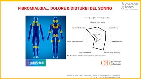 Fibromialgia La Serie Parte Iii I Sintomi Principali Medical