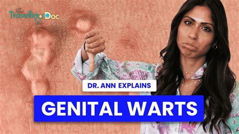 What Do Genital Warts Look Like The Ultimate Guide And Do They Go Away Youtube