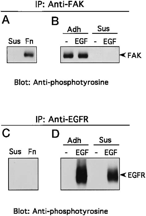 Comparison Of Tyrosine Phosphorylation Patterns Induced By Cell