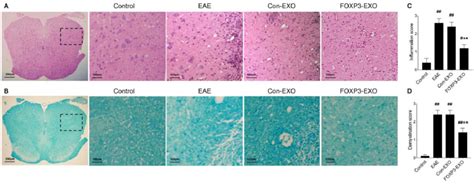 Foxp Exos Treatment Ameliorate Inflammatory Infiltration And