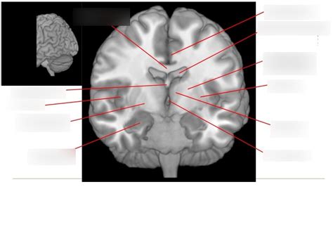 MRI Cerebrum Cross Section 9 Neuro Exam 2 Diagram Quizlet