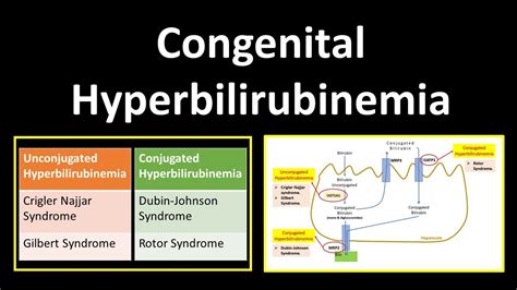 Pathology Congenital Hyperbilirubinemias Kembara Xtra