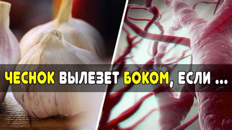 Когда чеснок вылезет боком: 6 болезней и состояний, при которых чеснок ...