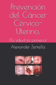 Prevenci N Del C Ncer C Rvico Uterino Tu Salud Es Primero Shop