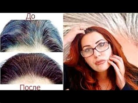 Как Избавиться от СЕДИНЫ! от Облысения! Простой Рецепт - YouTube