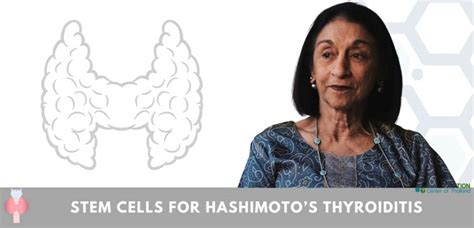 Stem Cell Treatment For Hashimotos Disease Chronic Thyroiditis