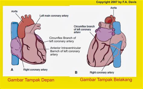 Miokard Infark Myocardial Infarction