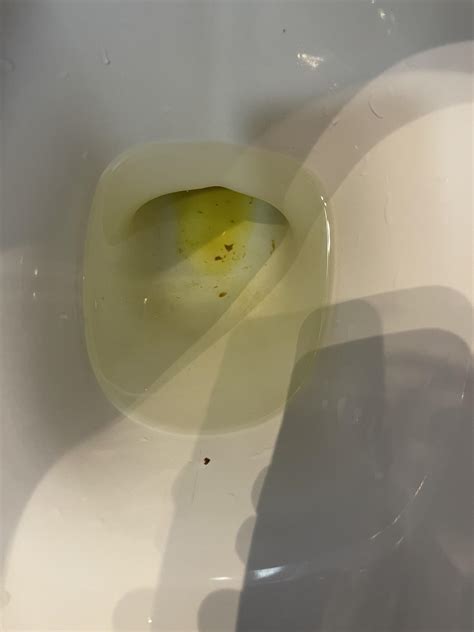 Yellow oily stool? : r/poop