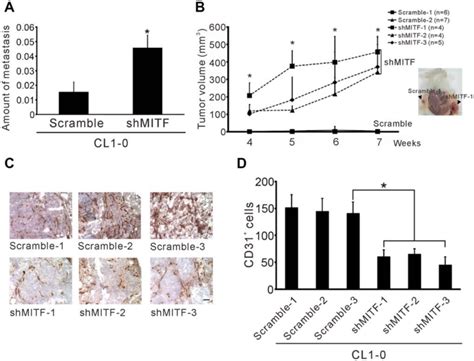 Knockdown Of MITF Increases Metastasis And Tumorigenesis But Inhibits