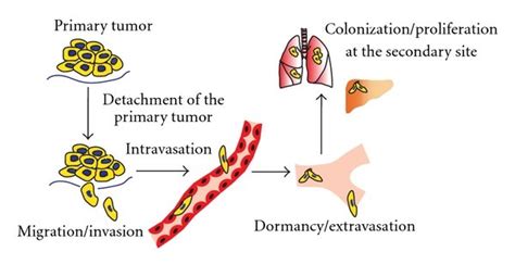 The Steps Of The Metastatic Cascade Download Scientific Diagram