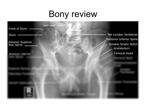 Solution Introduction To Abdominal X Ray Interpretation Studypool