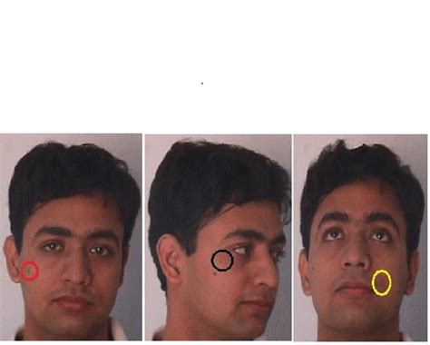 Three Different Types Of Example Of Facial Marks Results Full Face