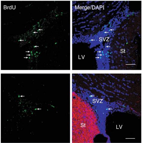 Proliferating Cells In The Subventricular Zone Svz And Th Cells In