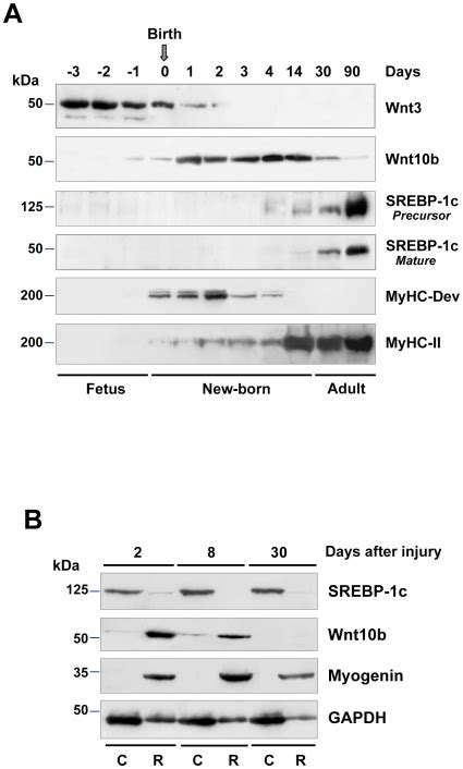 A Western Blot Analysis Showing Inverse Expression Patterns Between Download Scientific