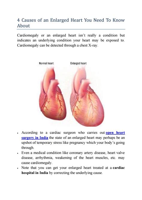 4 Causes of an Enlarged Heart You Need To Know About by Manya Verma - Issuu