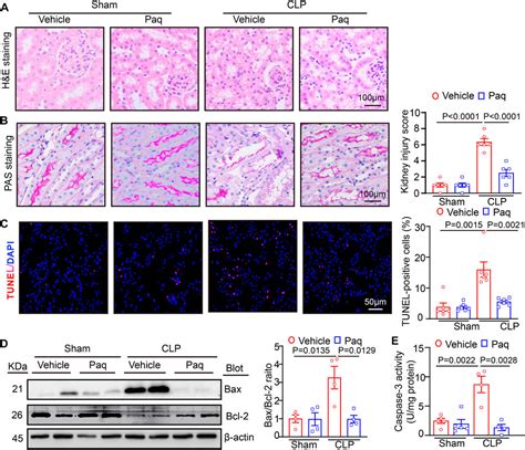 Frontiers Blockage Of S100a8a9 Ameliorates Septic Nephropathy In Mice