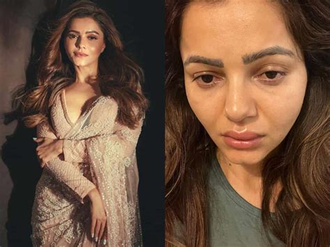 Fans Concerned For Rubina Dilaiks Health After Her Latest Pic