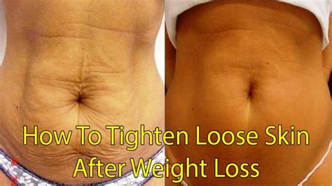 How To Tighten Excess Skin After Weight Loss With Castor Oil Skin