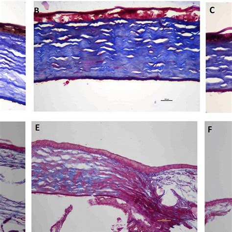 Masson Trichrome Staining For Evaluation Of Collagen Fiber