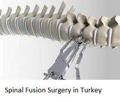 Spinal Fusion Surgery In Turkey Find The Best Hospitals Costs