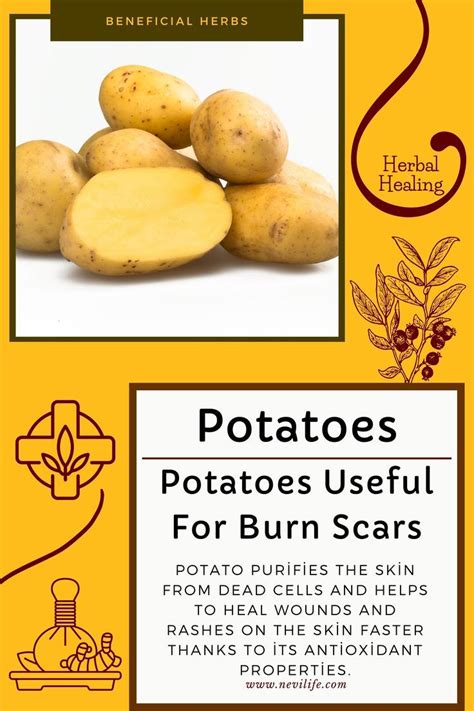 Potatoes For Burn Scars Relief