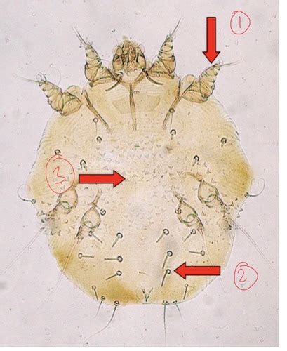 SKIN- mites (definition first) Flashcards | Quizlet