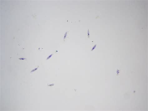 Pc Paramecium Caudatum Prepared Slide X Objective Flickr